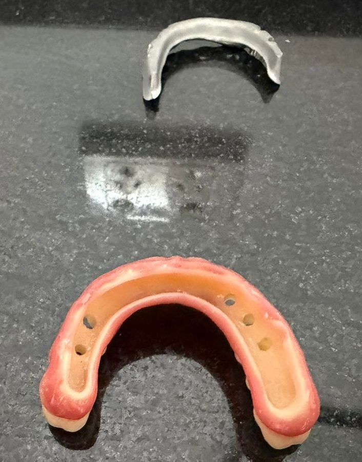 Manufacturing stage: printed components of the full-arch restoration